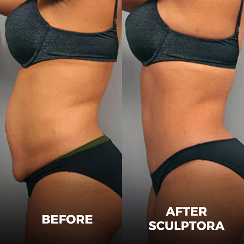 SCULPTORA 3 in 1 Technology + 3 FREE GIFTS