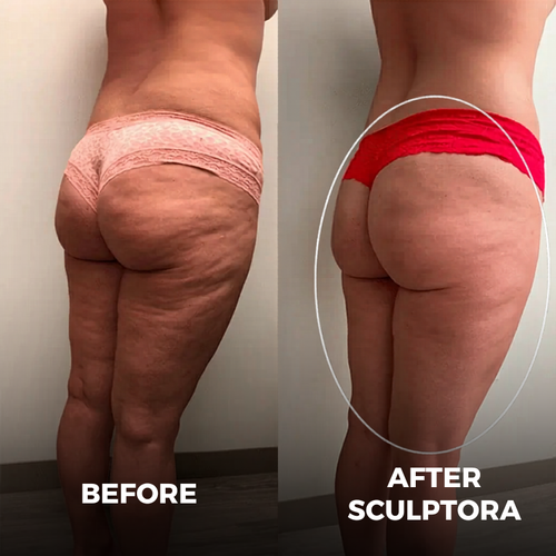 SCULPTORA 3 in 1 Technology + 3 FREE GIFTS